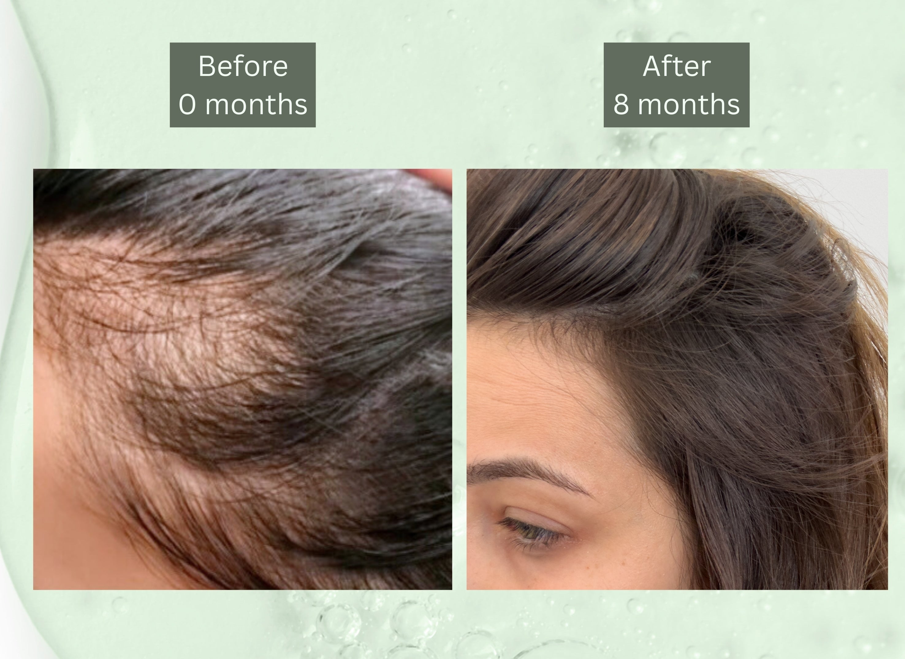 מארז להזנה ובריאות השיער